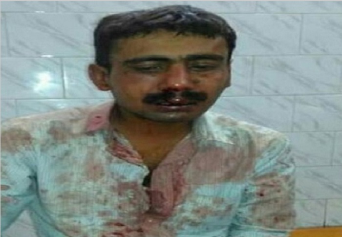 Rakesh Kumar बिहार में जंगलराज, पत्रकार को 3 घंटे तक पीटा