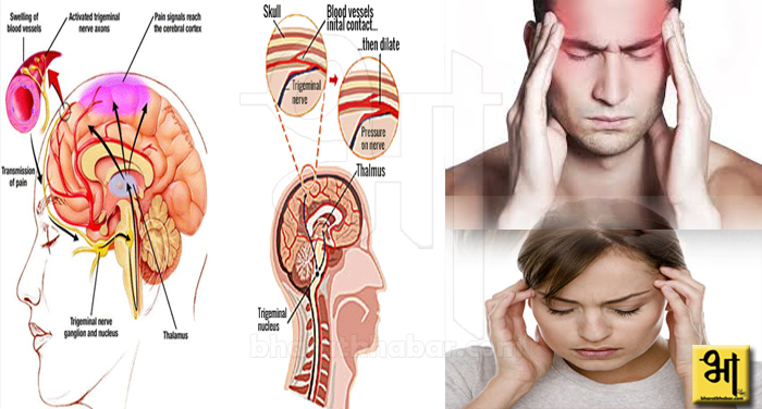 Headache 2 आपके सिर में भी रहता है दर्द तो अपनाएं ये घरेलू तरीके, मिलेगा फायदा