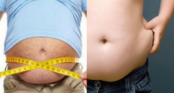 motapa मोटापे को कम करने वाली दवा को एफडीए की मंजूरी, 15 फीसदी वजन कम करने का दावा!