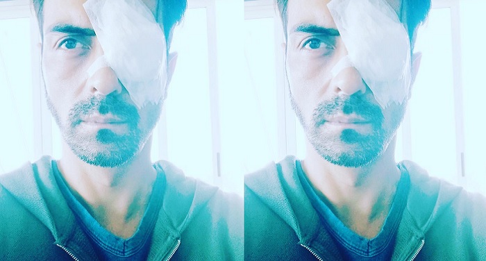 arjun rampal जानिए पाइरेट्स की आंख का दर्द कैसे बना अर्जुन का सिरदर्द ?