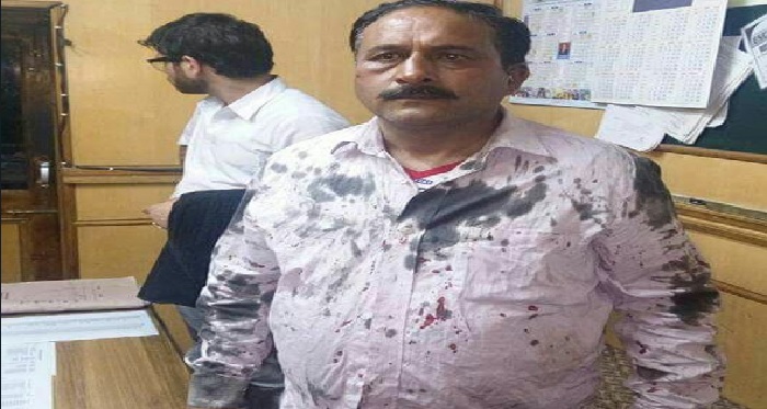 sanjy नगर निगम चुनाव खत्म होने के बाद बीजेपी में शामिल संजय परमार पर हमला