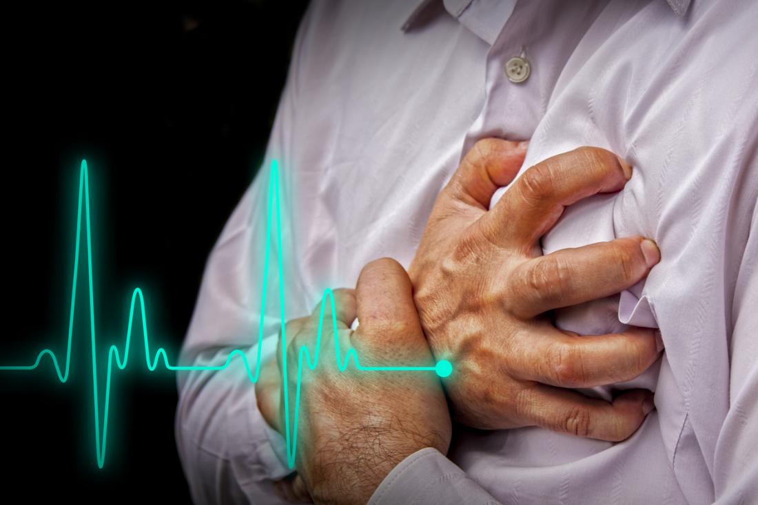 heart attacks are a serious form of heart disease with many different causes दोपहर में एक घंटे से ज्यादा सोने से होगी दिल की बीमारी