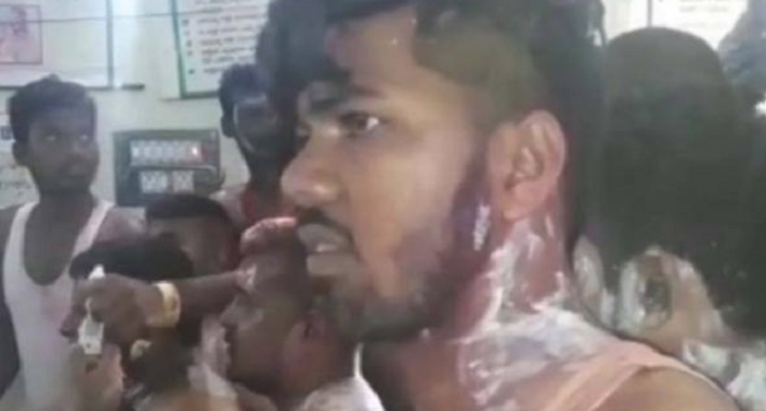 कांग्रेस की रैली के दौरान कार्यकर्ताओं पर एसिड अटैक,10 कार्यकर्ता घायल