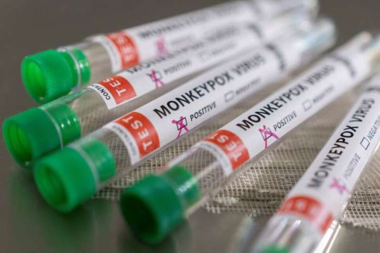 download 9 Monkeypox: दिल्ली में मंकीपॉक्स का चौथा मरीज, 31 वर्षीय नाइजीरियन युवती की रिपोर्ट आई पॉजिटिव