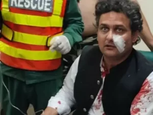 untitled11 1667475813 पाकिस्तान : इमरान खान के लॉन्ग मार्च में हुई फायरिंग, पैर में लगी गोली